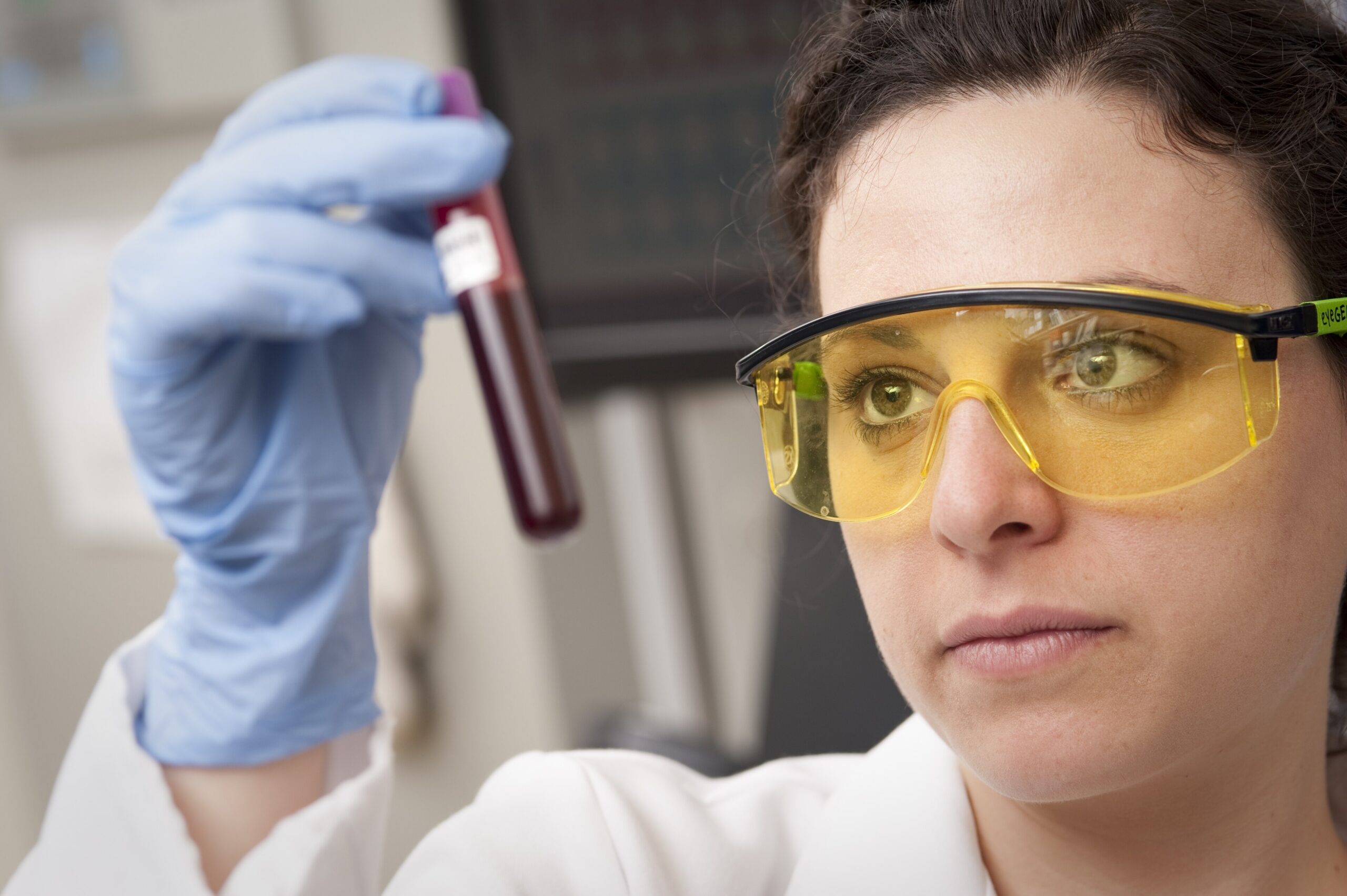 Checking-Blood-Sample-9955279835.jpg Wissenschaftlerin prüft eine Blutprobe im Labor