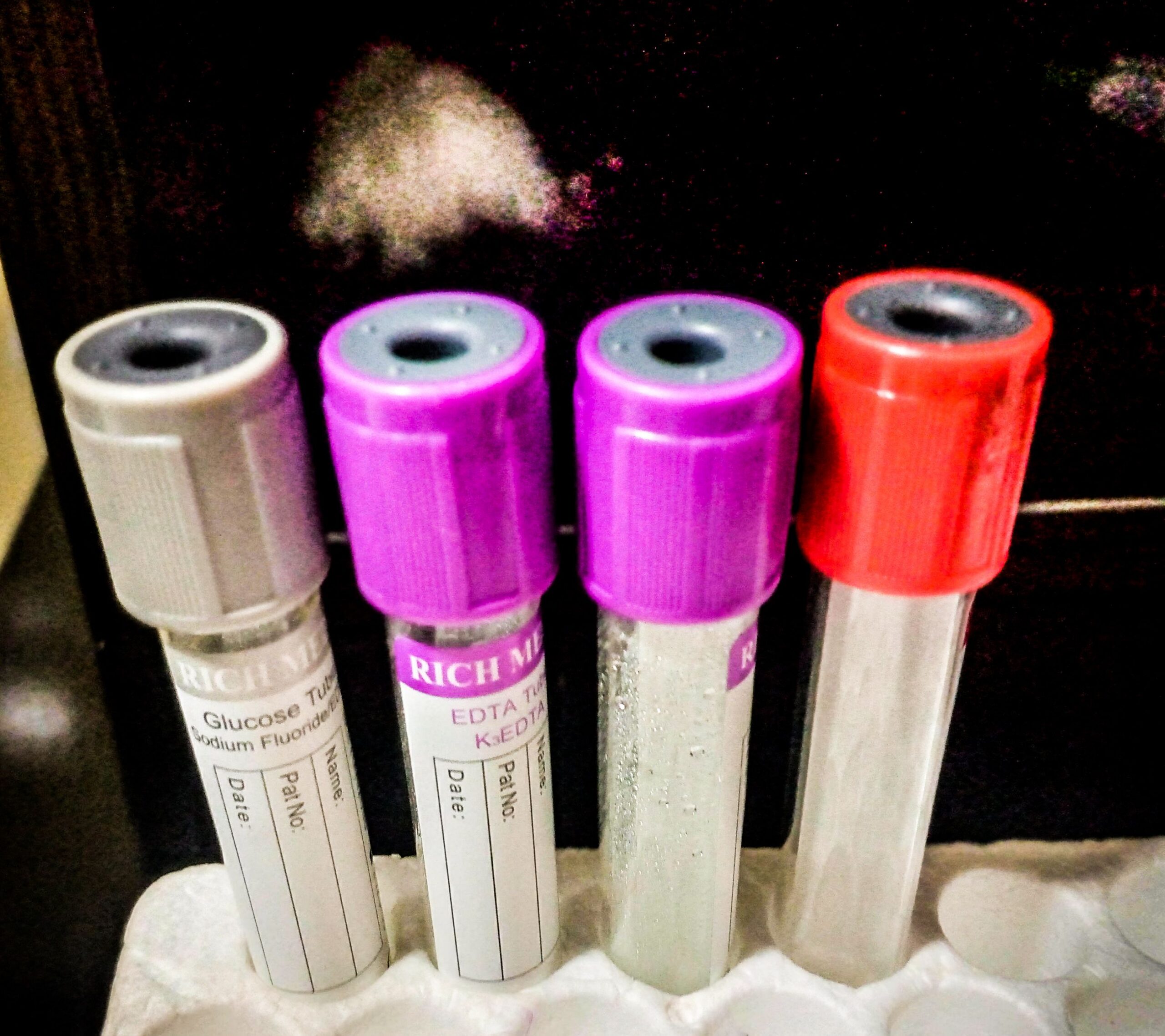 Laboratory-Test-Tubes-from-a-medical-laboratory-in-Abuja-Nigeria.jpg Reagenzgläser in einem medizinischen Labor